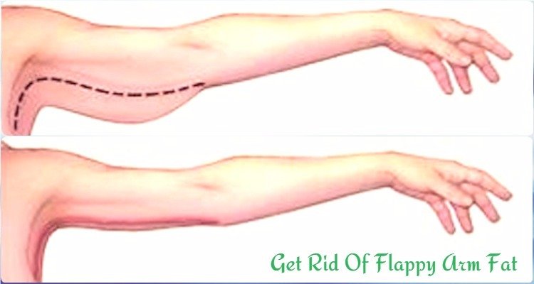 Ways to Get Rid Of Flappy Arm Fat Slim Arm Workouts At Home
